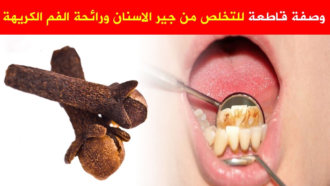 هل لرائحة الفم والاسنان علاقة بالسحر