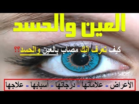 العين وعلاماتها وطرق علاجها باذن الله 847