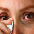 الجديد في الخلايا الجذعية وعلاج أمراض العيون | الوفد